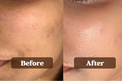 HydraGlow: Ayurvedic Powdered Face Wash for Deep Hydration & Calm | Lab-Tested & Natural